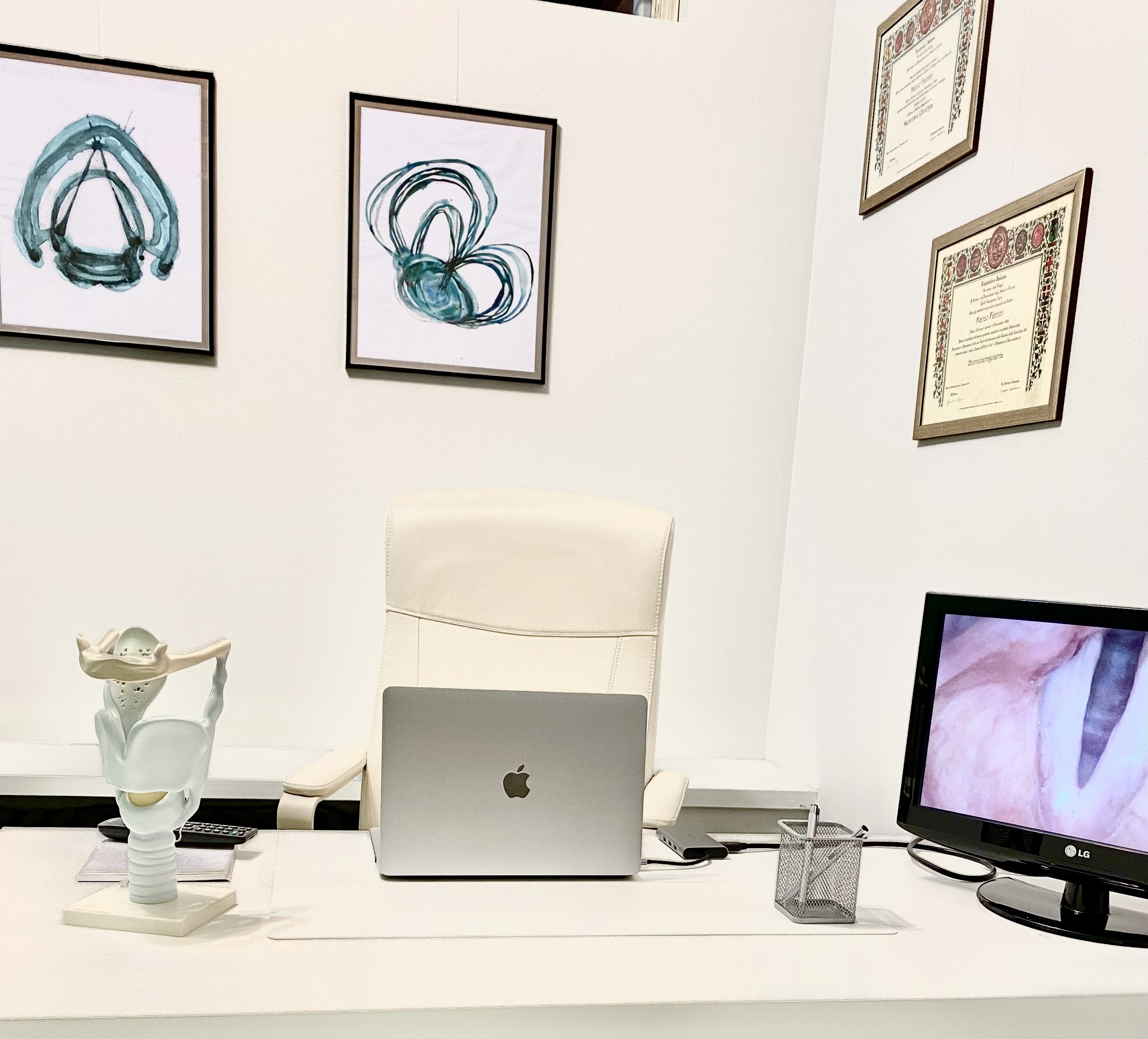 Postazione clinica dello Studio Calliope: modello anatomico della laringe sulla scrivania e monitor con immagine endoscopica delle corde vocali